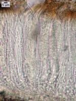 Acarospora fuscata image