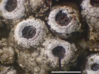 Acarospora thelococcoides image