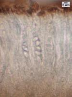 Anamylopsora pulcherrima image
