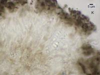 Arthonia phaeobaea image