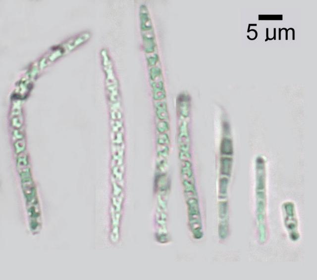 Bactrospora cascadensis image