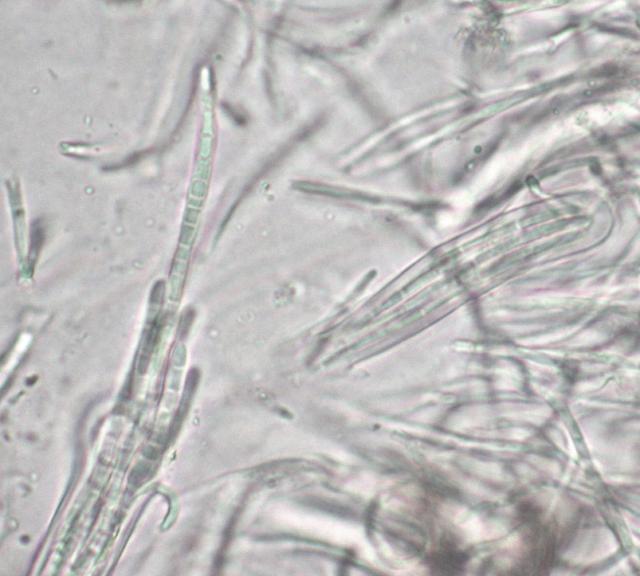 Bactrospora patellarioides var. convexa image