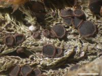 Bryobilimbia hypnorum image