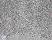 Calicium lenticulare image