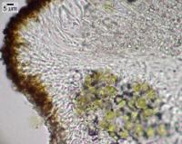 Caloplaca pellodella image