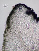 Caloplaca atrosanguinea image