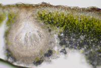 Catapyrenium psoromoides image