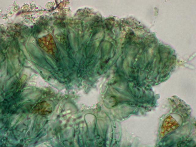 Catillaria erysiboides image