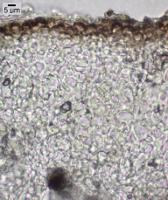 Heteroplacidium congestum image
