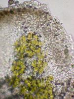 Acarospora nodulosa image