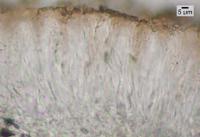 Lecanora salicicola image