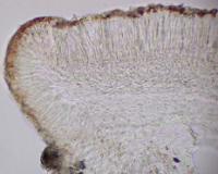 Lecidea erythrophaea image