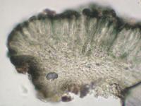 Lecidea turgidula image
