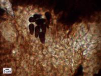 Lichenothelia scopularia image