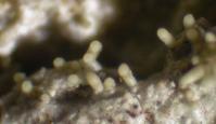 Loxosporopsis corallifera image