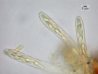 Image of Melaspilea interjecta