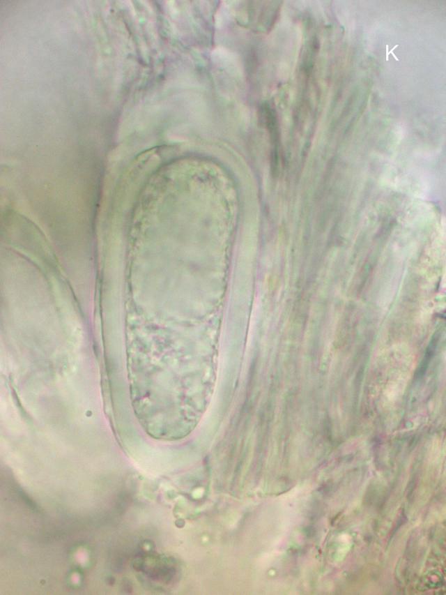 Mycoblastus sanguinarioides image
