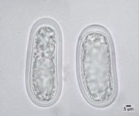 Mycoblastus sanguinarioides image