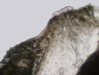 Pertusaria glomerata image