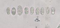 Placidiopsis pseudocinerea image