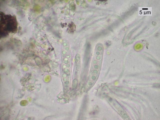 Placynthiella hyporhoda image