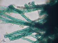 Placynthium flabellosum image