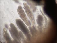 Polyblastia albida image
