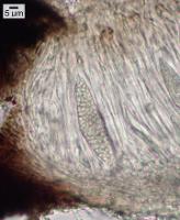 Polysporina urceolata image