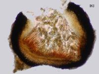 Protothelenella pluriseptata image