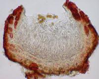 Pyrenopsis furfurea image