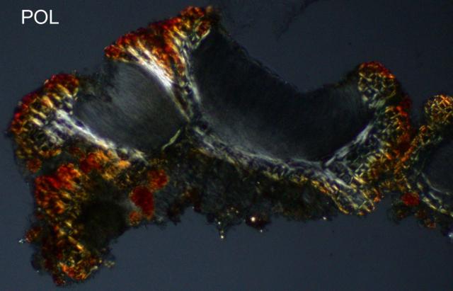 Pyrenopsis furfurea image