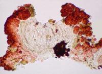 Pyrenopsis grumulifera image