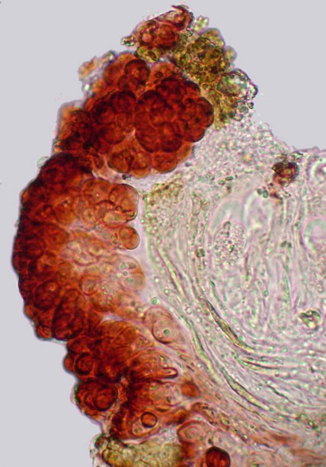 Pyrenopsis grumulifera image