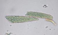 Sarcosagium campestre image