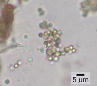 Strangospora microhaema image
