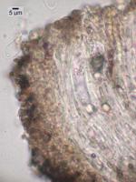 Trapelia glebulosa image