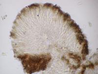 Xylographa stenospora image