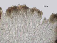 Xylographa stenospora image